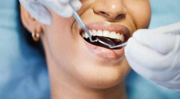 Best Emergency Tooth Extraction in Francis, UT
